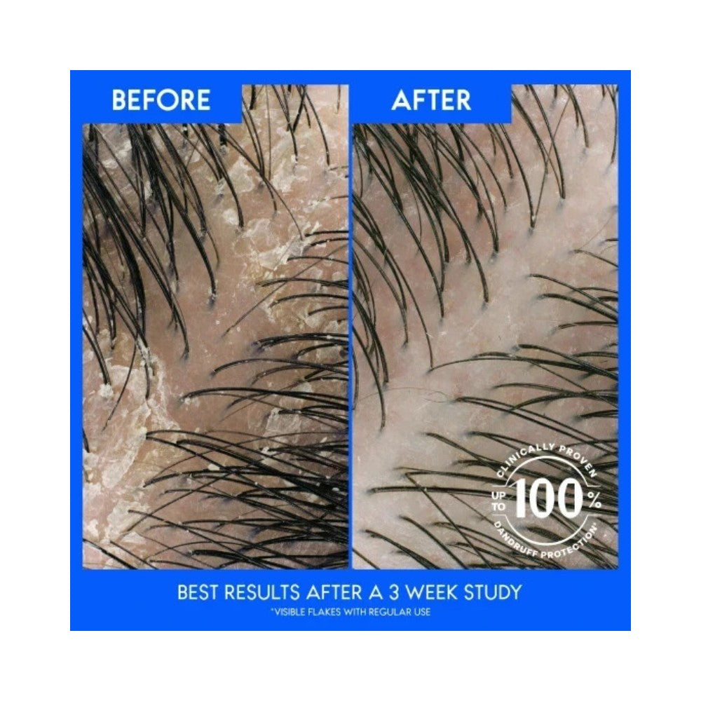 Head & Shoulders 2 in 1 Classic Clean Shampoo & Conditioner 330ml