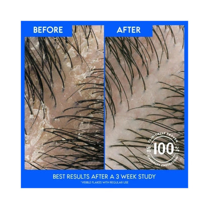 Head & Shoulders 2 in 1 Classic Clean Shampoo & Conditioner 330ml