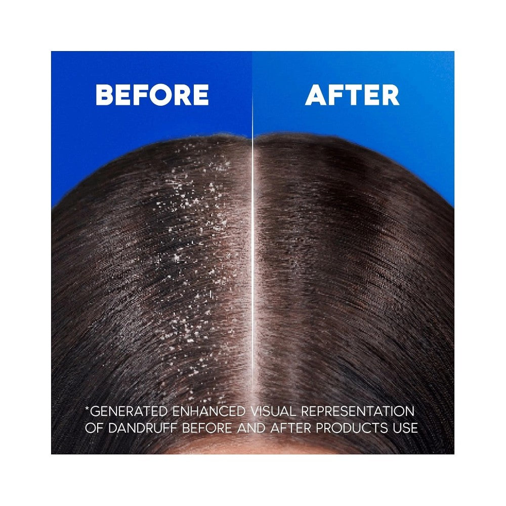 Head & Shoulders 2 in 1 Classic Clean Shampoo & Conditioner 330ml