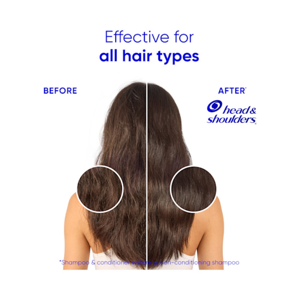 Head & Shoulders 2 in 1 Smooth & Silky Anti-Dandruff Shampoo & Conditioner 400ml