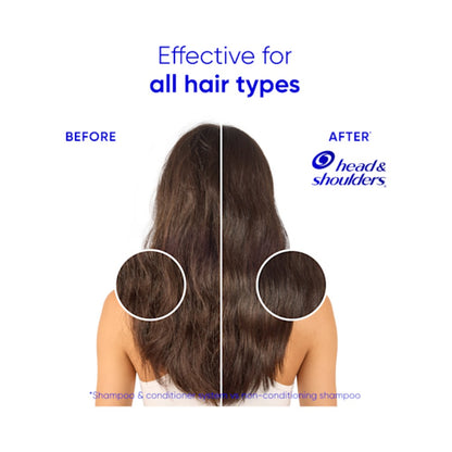 Head & Shoulders 2 in 1 Smooth & Silky Anti-Dandruff Shampoo & Conditioner 400ml